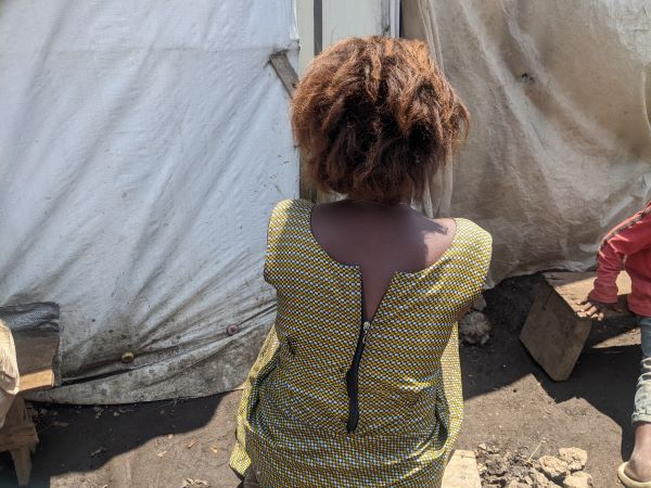 Une des victimes d’abus sexuels vivant dans un camp de déplacés de guerre à Goma © Photo Katembo Mbuto Victoire